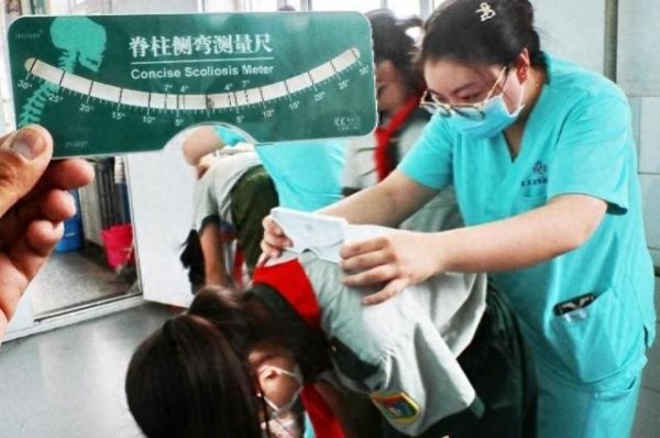 凯丰配资 暑期迎来“脊柱矫形”热？专家提醒：科学干预少走弯路